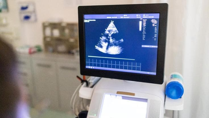 Il cuore perde il ritmo? Il radar ci avvertirà