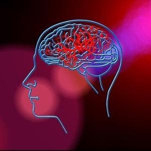 Ictus e infarto, con la tecnica “aspira e ruota” attacco diretto ai trombi pericolosi