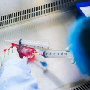 Tumori, a chi serve la biopsia liquida?