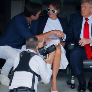 Trump ha una insufficienza venosa cronica alle gambe, di che cosa si tratta