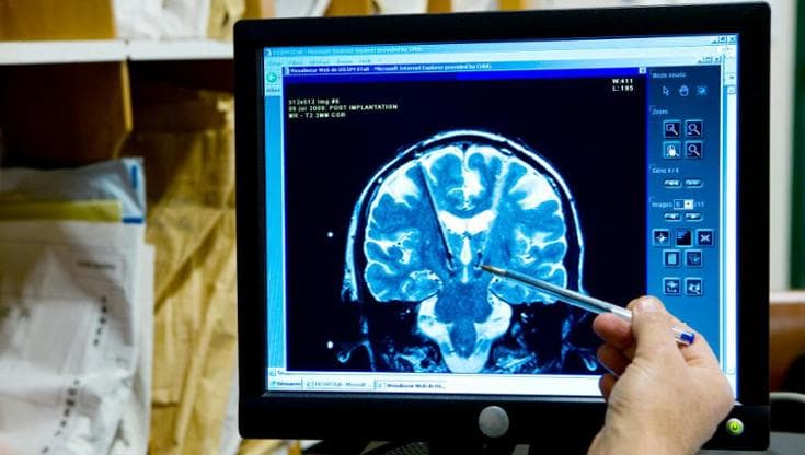 Pressione alta che non scende? Potrebbe nascere (anche) nel cervello