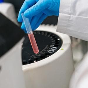 Infarto, arriva il “tritest”: con tre esami del sangue sapremo chi è a maggior rischio