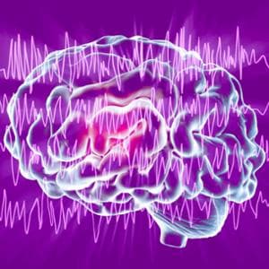 Epilessia: un biomarcatore potrebbe prevedere le crisi in anticipo