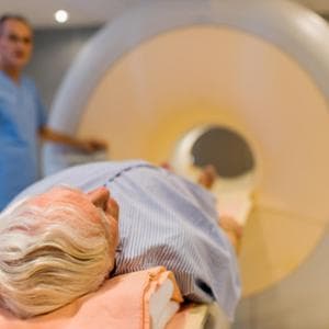 Tumore della prostata: radioterapia alternativa efficace alla chirurgia radicale