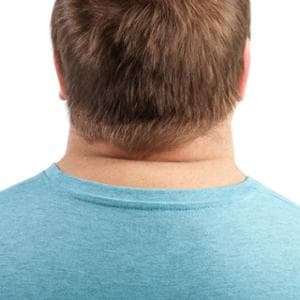 Kalp ve bel büyüklüğü dekompansasyon riskini ağırlık ve boydan daha iyi gösterir (sadece değil)