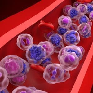 Linfoma aggressivo, una nuova combinazione di farmaci raddoppia la sopravvivenza a tre anni