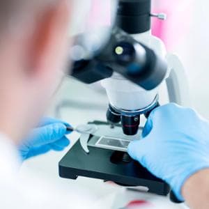 Tumore al seno, un comune antinfiammatorio potrebbe aumentare l’efficacia delle terapie ormonali