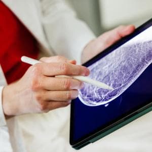 Tumore del seno: con l’intelligenza artificiale possibile estendere i programmi di screening