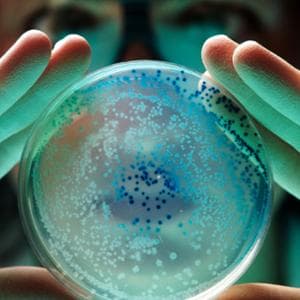 Tumore del rene, il trapianto di microbiota migliora la risposta all’immunoterapia