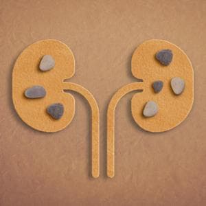 Böbrek taşları: bakteriler de bunların oluşumunu teşvik eder