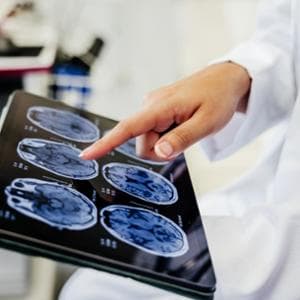 C’è ma non si vede: quel grasso nascosto che danneggia la salute del cervello
