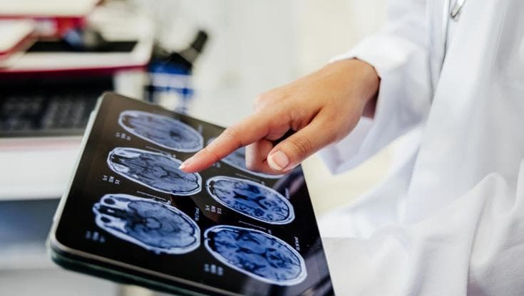 C’è ma non si vede: quel grasso nascosto che danneggia la salute del cervello