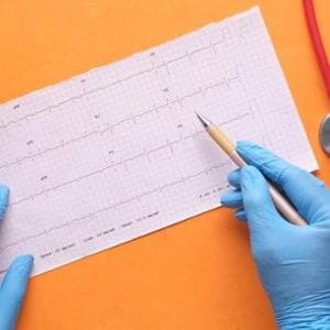 Come rafforzare e salvaguardare il cuore durante la chemioterapia? Esercizio fisico costante? Riposo? Dieta mirata?