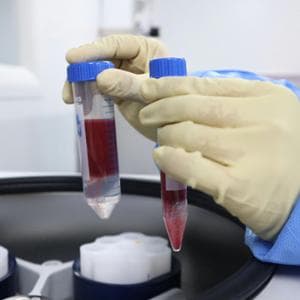 Un test del sangue ‘svela’ chi vivrà più a lungo