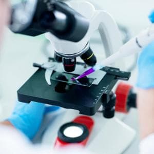 Linfoma follicolare: con la chemio-immunoterapia quasi metà dei pazienti riesce a guarire