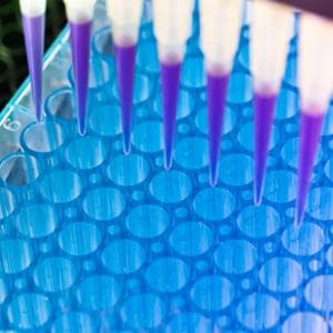 Biopsia liquida per trovare i tumori? La strada è ancora lunga