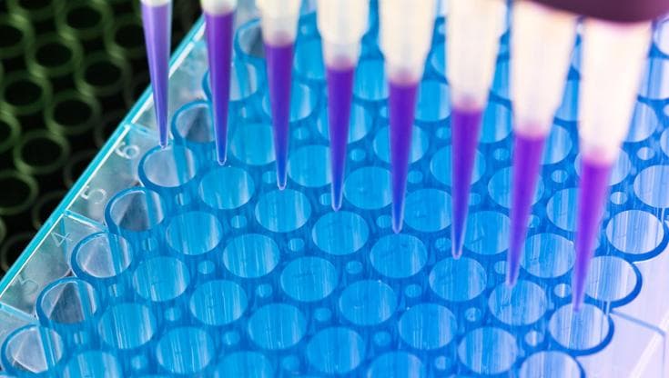 Biopsia liquida per trovare i tumori? La strada è ancora lunga