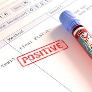 Epidural ile ama ayakta doğum yapmak: doğumun yeni sınırı