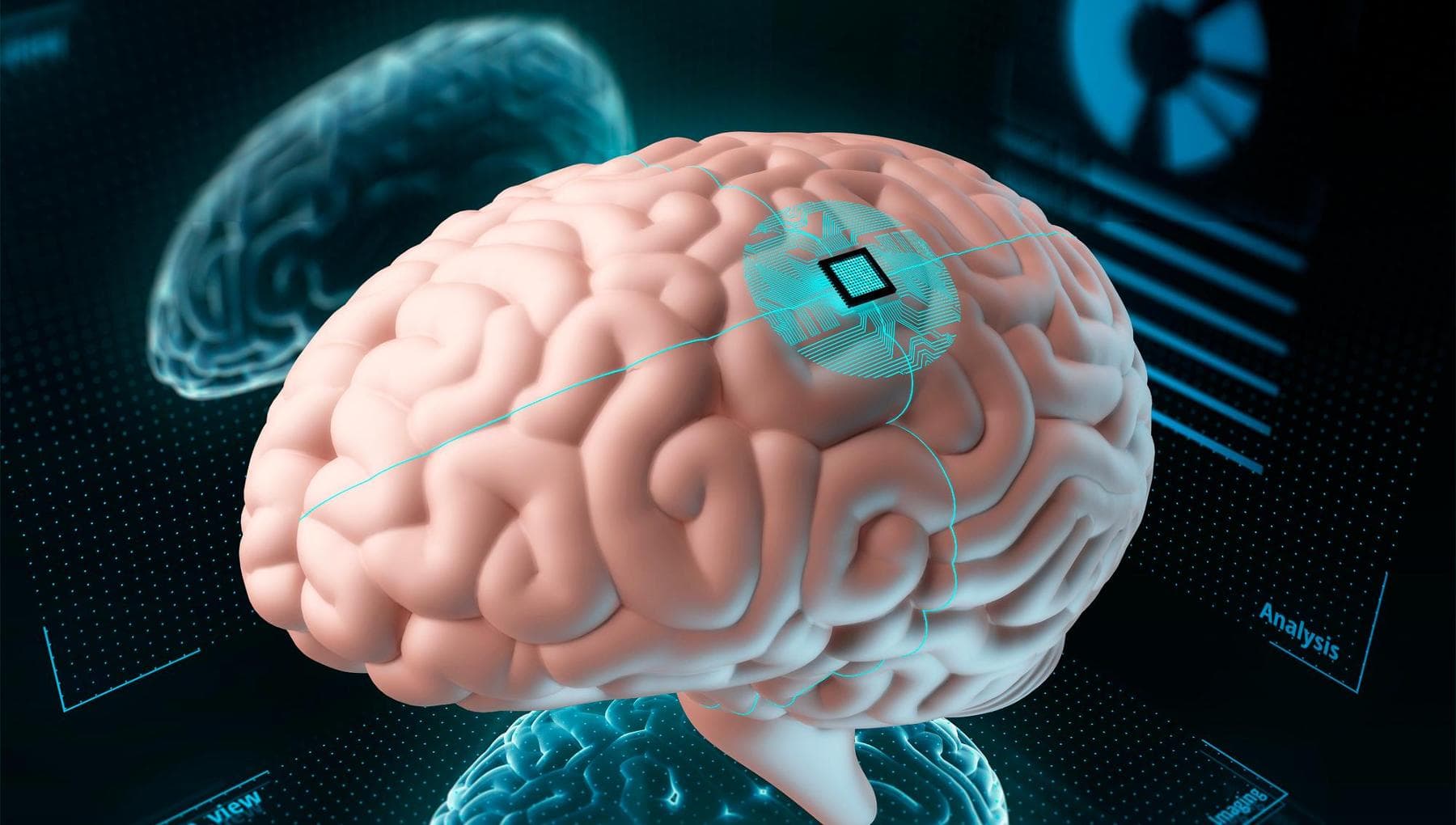 Çin, ilk beyin çipinin takası için yeşil ışık yaktı (ve Musk'ı geride bıraktı)