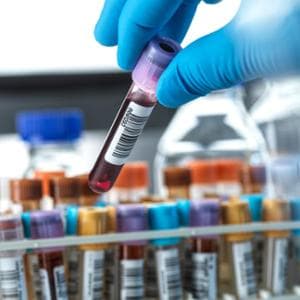 ABD'nin önerisi: diyabet öncesi kelimesini ortadan kaldırın, riski hafife alın