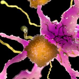 Alzheimer, hastalığı öngören sekiz belirteç (üç yıl içinde)