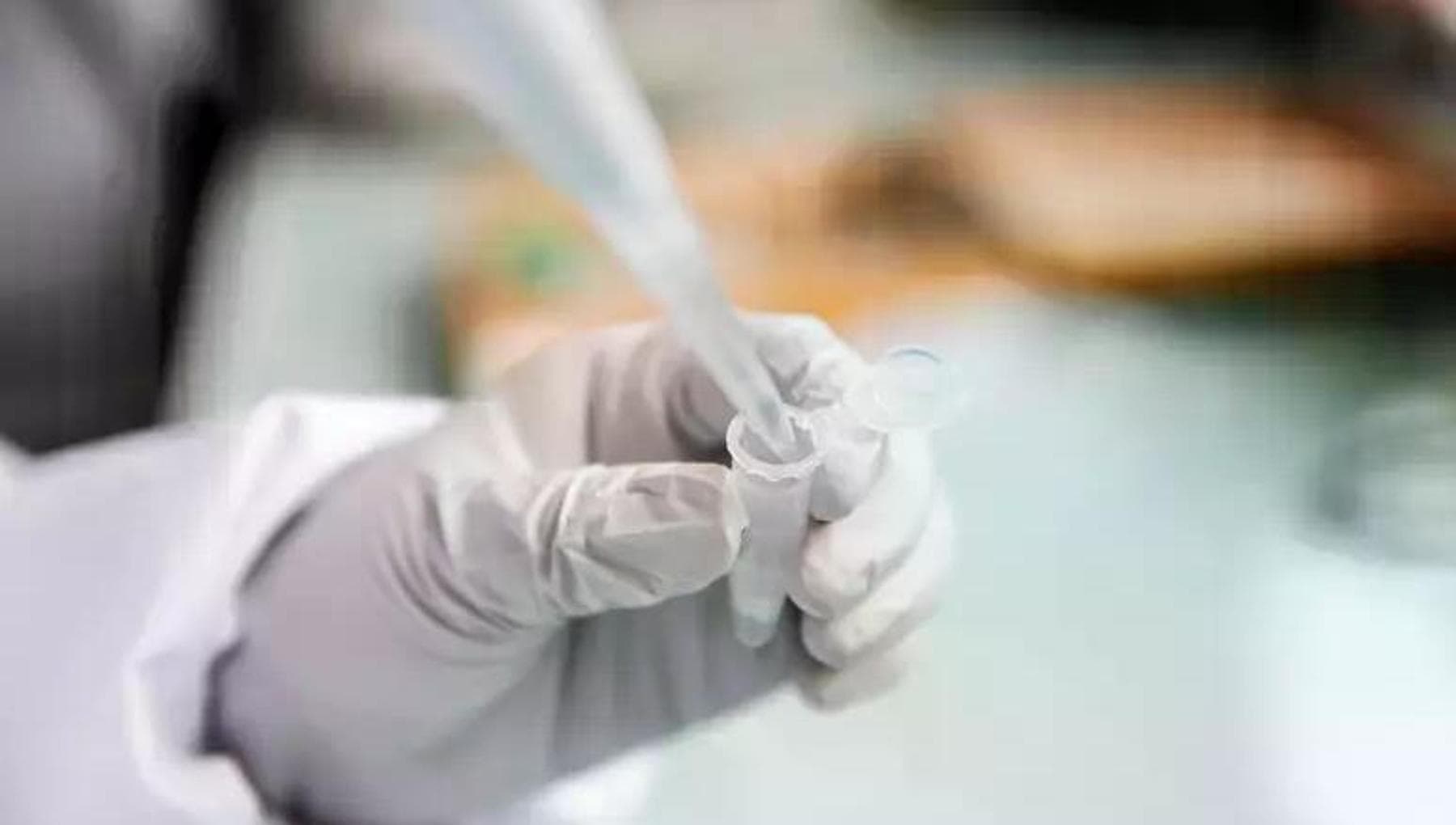 ABD'de tedavisiz iyileşme gösteren bir kadında tümörler