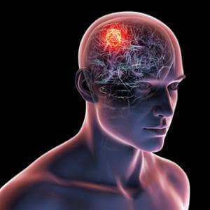 Glioblastoma, risultati promettenti per un vaccino personalizzato