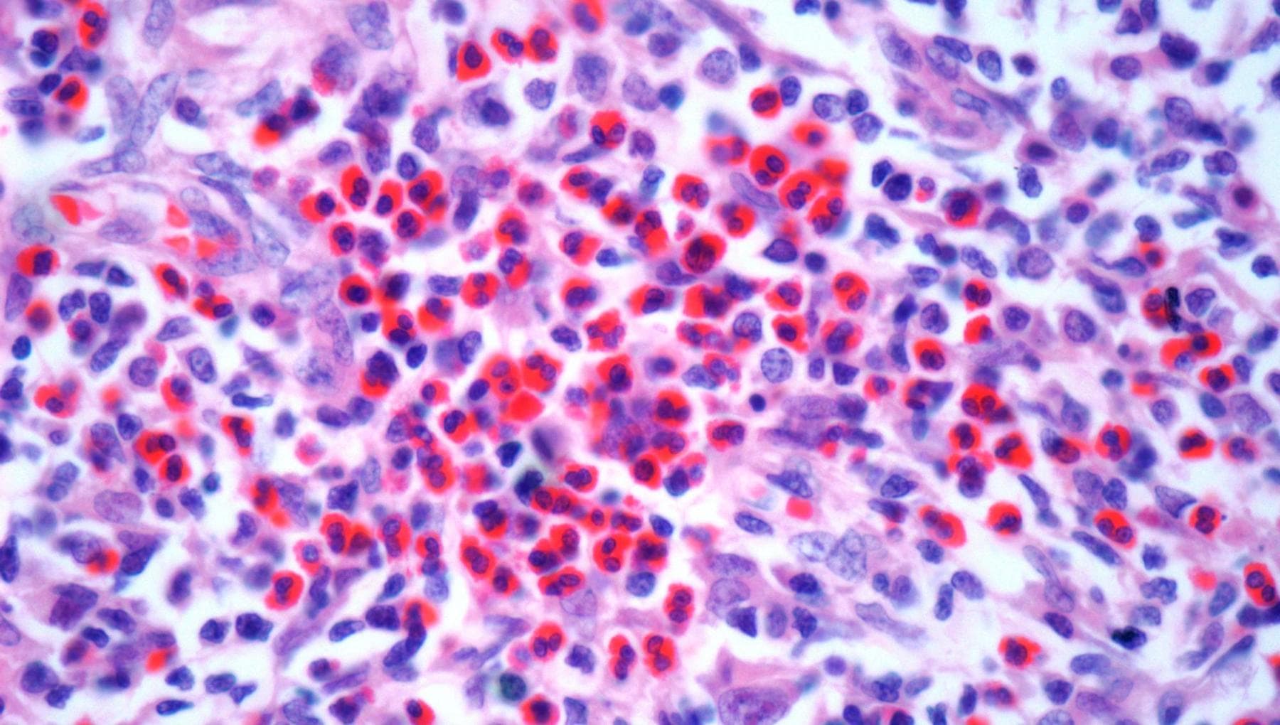 Nuove terapie oncologiche
