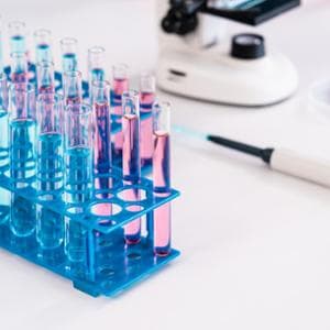 Sağlık hizmeti bekleme listeleri, dört buçuk milyon İtalyan testlerden ve ziyaretlerden vazgeçti