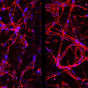 Retina, così le staminali possono riparare i vasi sanguigni