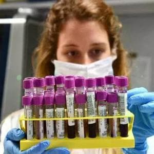 Alzheimer, la nuova mappa del rischio è nel sangue