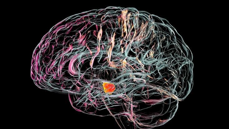 Micro-antenne nel cervello contro Parkinson ed epilessia