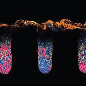 Organoidi e algoritmi: così si studia la biologia delle malattie umane