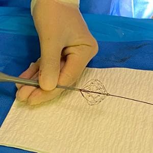 Fibrillazione atriale, per la prima volta in Italia la procedura con catetere a campo pulsato