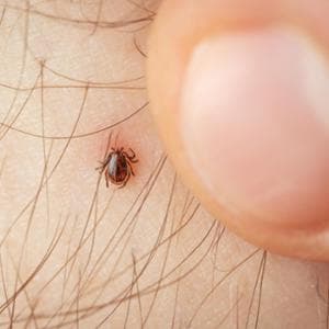 Zecche, che malattie possono trasmettere: dati triplicati negli ultimi anni