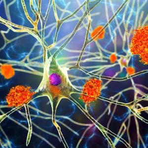 Le alterazioni della microglia possono contribuire allo sviluppo delle malattie neurodegenerative