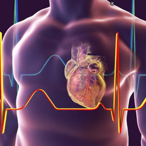 Infarto, ictus e non solo: un test basato sull’IA dirà chi è a rischio 15 anni prima