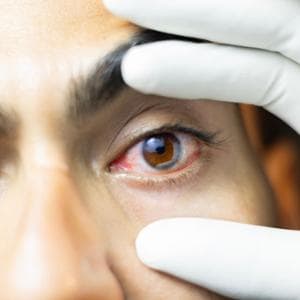 Glaucoma, ecco come affrontare l’estate