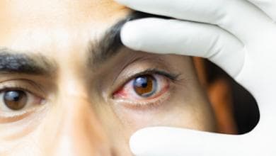 Glaucoma, ecco come affrontare l’estate