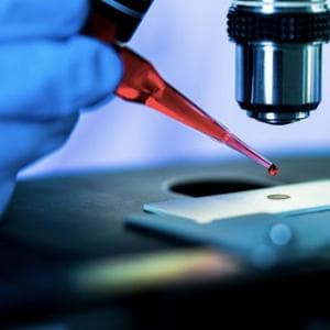 Esami di laboratorio, tariffe diverse nelle regioni: lo studio SIBioC chiede regole più uniformi