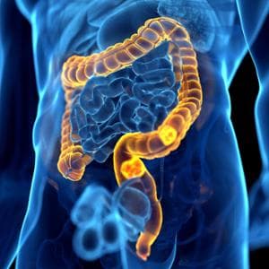 Tumore al colon-retto, quanto sono efficaci gli screening?