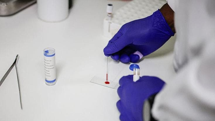 Malaria, cosa la scatena e come riconoscerla