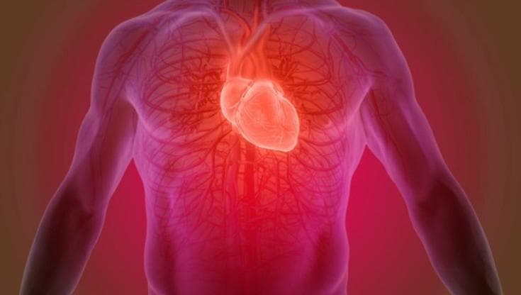 Infarto acuto, ecco l’analisi in 3D che aiuta a capire per quali arterie serve lo stent