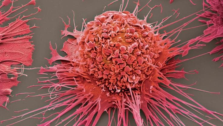 Perché il grasso viscerale fa così male? Colpa dei macrofagi impazziti