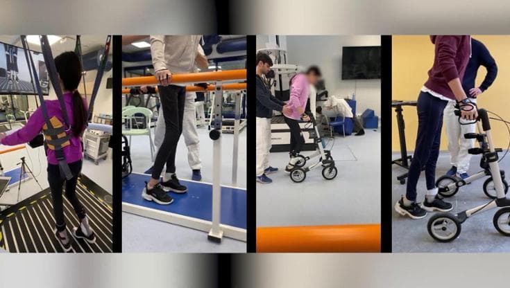 Quattro persone con lesioni di midollo complete tornano a camminare: la tecnica nata in Italia