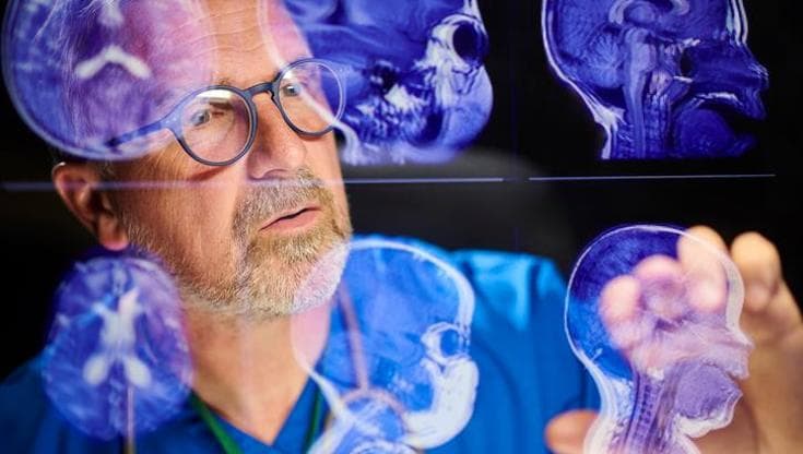Tumori cerebrali, la nuova frontiera è decifrare la “carta d’identità” del glioma