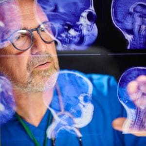 Tumori cerebrali, la nuova frontiera è decifrare la “carta d’identità” del glioma