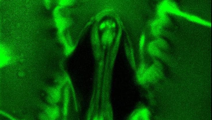 (foto: University of Illinois Urbana-Champaign, Plant Physiology)