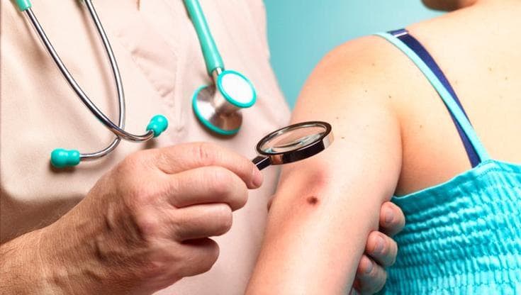 Melanoma, il primo vaccino personalizzato a mRNA riduce del 42% il rischio che il tumore ritorni