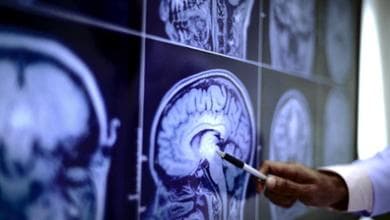 Micro-ictus silenti, il rischio sale se si eccede con alimenti ultraprocessati